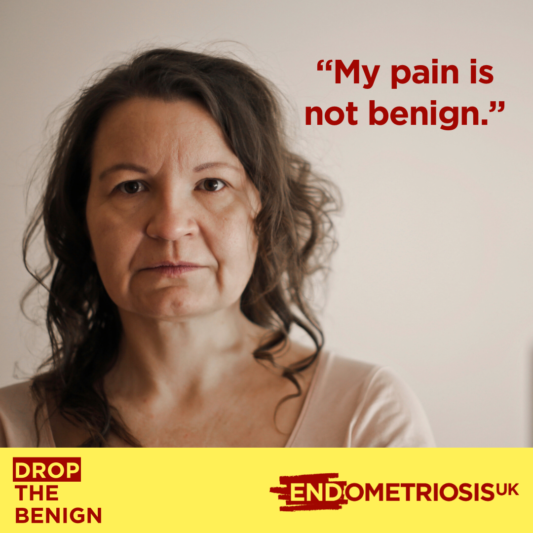 Campaign graphic featuring a close-up portrait of a person with shoulder-length dark wavy hair against a plain light background. Dark red text in the top-right corner reads: “My pain is not benign.” A pale yellow banner runs along the bottom of the image, displaying the campaign message “DROP THE BENIGN” on the left and the Endometriosis UK logo on the right.