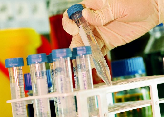 The National Institute for Health Research is recruiting women with endometriosis for the PRE-EMPT clinical trial