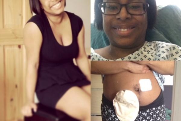 Photo collage of endometriosis case study Nadine